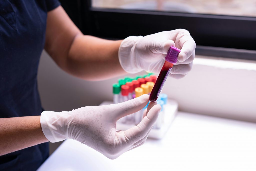 Lab technician handling blood test vials